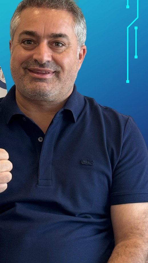 Saç ekimi öncesi ve sonrası sonuç