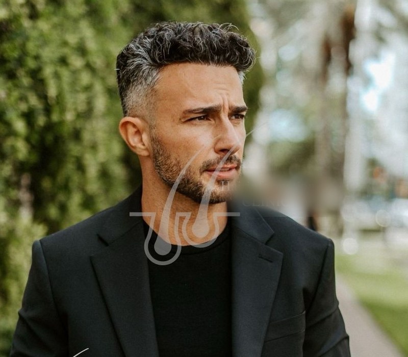 Hair Information Clinic — doğal saç ekimi sonucu